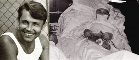 Dr Leonid Rogozov: The Soviet Surgeon Who Removed His Own .